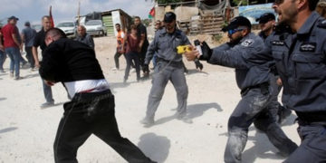 صیہونی پولیس  نے فلسطینی خاتون کے سرمیں گولی مار دی