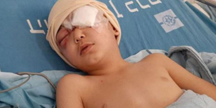 صیہونی فوج نے فلسطینی بچے کی آنکھ میں گولی ماردی