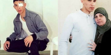 صہیونی فوج کی فائرنگ سے آنکھ سے محروم ہونے والا فلسطینی نوجوان جیل سے رہا