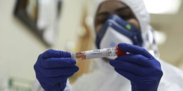 غزہ میں کورونا کے 5 نئے مریضوں کی تصدیق، مجموعی تعداد 41 ہوگئی