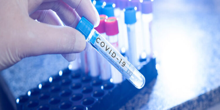  فلسطین میں عالمی وباءکوروناوائرس کےپھیلاؤمیں واضح کمی