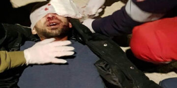 صہیونی آبادکاروں کی دہشتگردی سے مظلوم فلسطینی شدیدزخمی