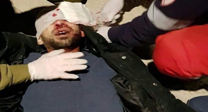 صہیونی آبادکاروں کی دہشتگردی سے مظلوم فلسطینی شدیدزخمی