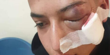 صیہونی فوج کی فائرنگ سے بچے سمیت 12فلسطینی زخمی