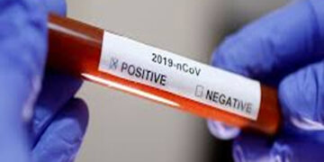 عالمی وبا کورونا سے غزہ میں 3 افراد جاں بحق