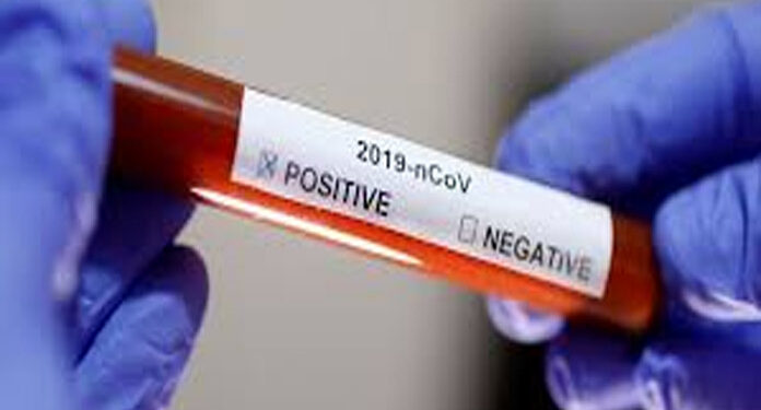 عالمی وبا کورونا سے غزہ میں 3 افراد جاں بحق