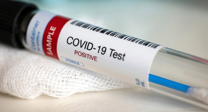 مقبوضہ فلسطین: 24گھنٹوں میں کورونا سے 21 افراد جاں بحق