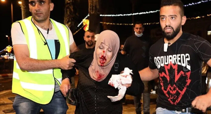 قبلہ اول میں صیہونی جارحیت، ترکی کی شدید مذمت