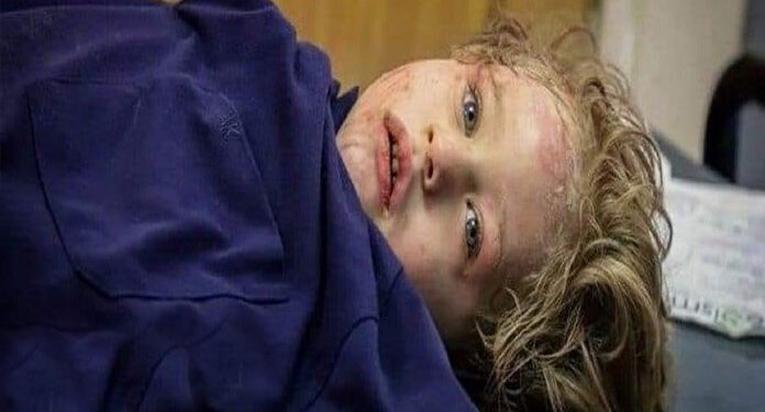 اسرائیلی بمباری اور معصوم فلسطینی بچے