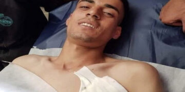 صیہونی فوج کی فائرنگ سے زخمی فلسطینی نوجوان گرفتار