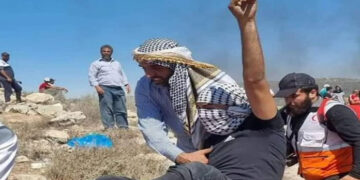 جبل الصبیح  میں صہیونی فوجی تشدد کے بعد فلسطینی زخمیوں کی تعداد 83 ہوگئی