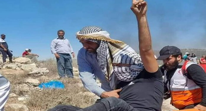جبل الصبیح میں صہیونی فوجی تشدد کے بعد فلسطینی زخمیوں کی تعداد 83 ہوگئی