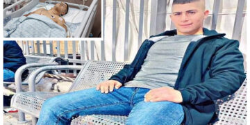 اسرائیلی فوجی فائرنگ: فلسطینی نوجوان گردے سے محروم ہوگیا