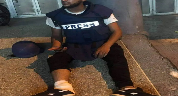 مقبوضہ فلسطین میں صہیونی فوج کی فائرنگ سے صحافی زخمی