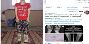 روزنامہ قدس نیوز ایجنسی سے فلسطینی شہری کا رابطہ، بیٹی کے علاج کیلئے پاکستان سے مدد کی اپیل