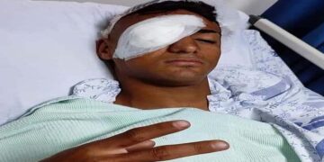 اسرائیلی فوجی کی اندھا دھند فائرنگ سے فلسطینی شدید زخمی