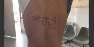 بھارتی بربریت: قیدی کے جسم پر گرم سلاخ سے دہشت گرد لکھوا دیا