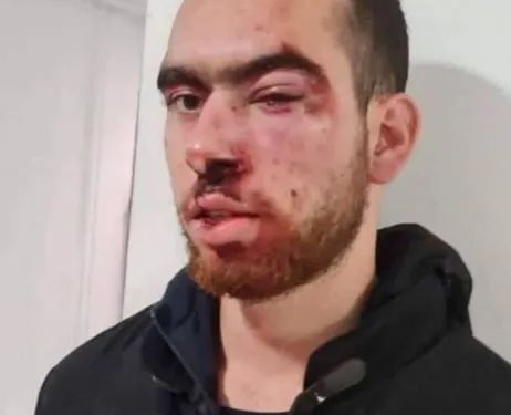 فلسطینی مظاہرین پر اسرائیلی فوج کا حملہ، بدترین تشدد کے بعد نوجوان گرفتار