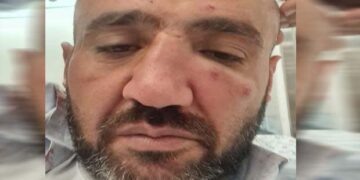 نہتے فلسطینی پر صہیونی آبادکاروں کا حملہ، ٹانگ توڑ ڈالی