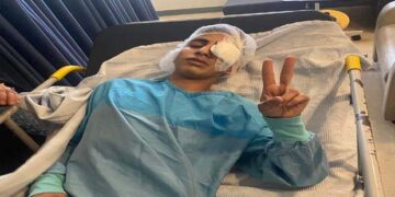القدس: صہیونی فوج کی فائرنگ سے فلسطینی بچے کی آنکھ ضائع ہو گئی