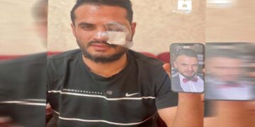 قابض فوج اور فلسطینوں میں جھڑپیں،  نوجوان آنکھ سے محروم ہو گیا