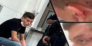 اسرائیلی فورسز کے ہاتھوں فلسطینی طالب علم پر تشدد اور گرفتاری