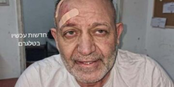 شیخ بسام السعدی کی گرفتاری اسرائیل کی سنگین غلطی ہے، اسرائیلی میڈیا