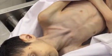 غزہ میں بھوک سے مزید تین بچے شہید، تعداد 23 ہوگئی