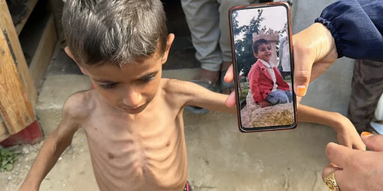 ایمنسٹی: غاصب اسرائیل غزہ میں بھوک کو نسل کشی کا ہتھیار بنا رہا ہے