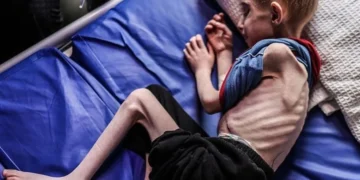 غزہ: بھوک سے مزید 14 شہادتیں، تعداد 147 ہو گئی