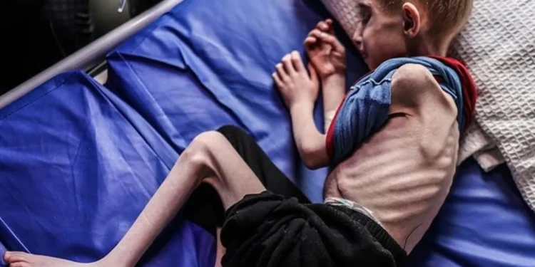 غزہ: بھوک سے مزید 14 شہادتیں، تعداد 147 ہو گئی