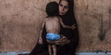 قابض صہیونی بھوک کی بربریت سے گیلین بیری کے آٹھ مریض شہید