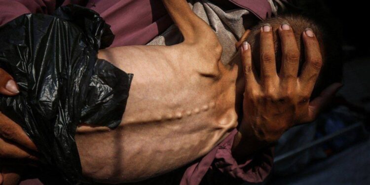 غزہ میں بھوک سے چھ سالہ محمد خضر شہید، صہیونی سفاکی بے نقاب