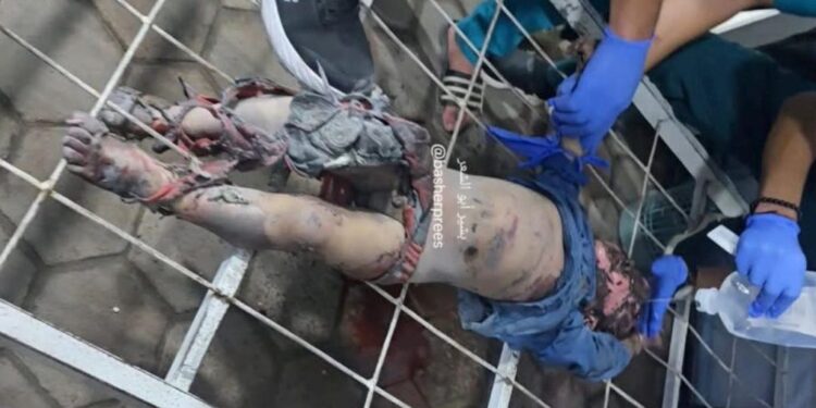 غزہ میں صہیونی فوج کا وحشیانہ حملہ: 28 شہید