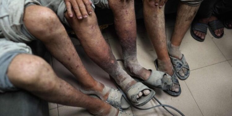 قابض اسرائیل سے 13 فلسطینی اسیران کی رہائی، جسموں پر شدید تشدد کے آثار