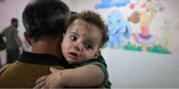 غزہ میں بچوں میں جلدی بیماریوں کے پھیلاؤ پر تشویش میں اضافہ
