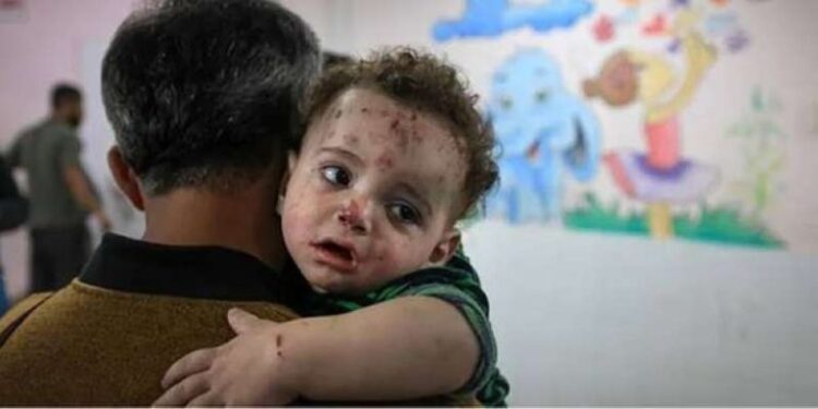 غزہ میں بچوں میں جلدی بیماریوں کے پھیلاؤ پر تشویش میں اضافہ