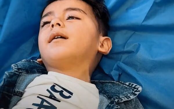غزہ میں تباہ حال نظامِ صحت کے باوجود ننھے یمان کا کامیاب آپریشن