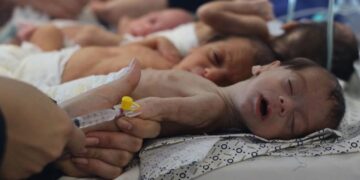 غزہ میں غذائی قلت سنگین، ہزاروں بچوں کی زندگیاں خطرے میں: مرکز حقوق انسانی