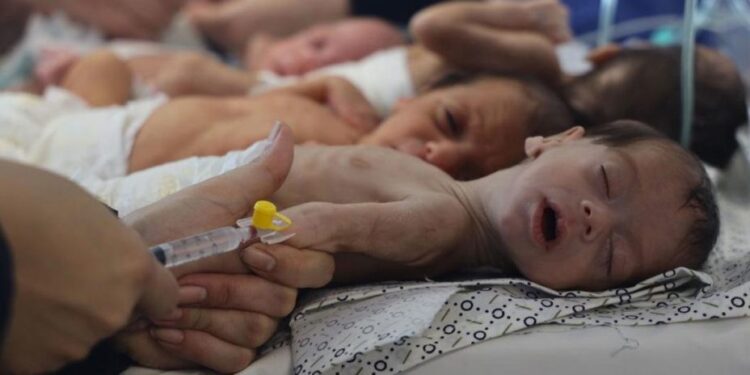 غزہ میں غذائی قلت سنگین، ہزاروں بچوں کی زندگیاں خطرے میں: مرکز حقوق انسانی