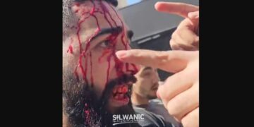 معذور بھائی کو بچانے کی کوشش، بیت المقدس میں نوجوان پر آبادکاروں کا وحشیانہ تشدد